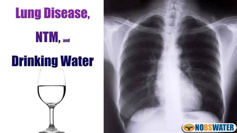 Can choking on water cause water in lungs?