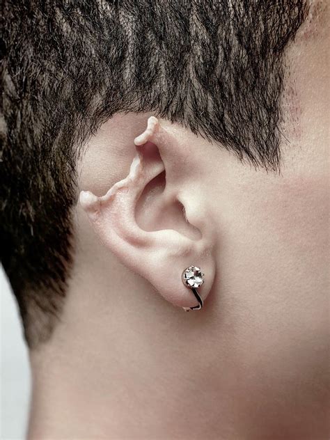 Can clip on earrings damage ears?
