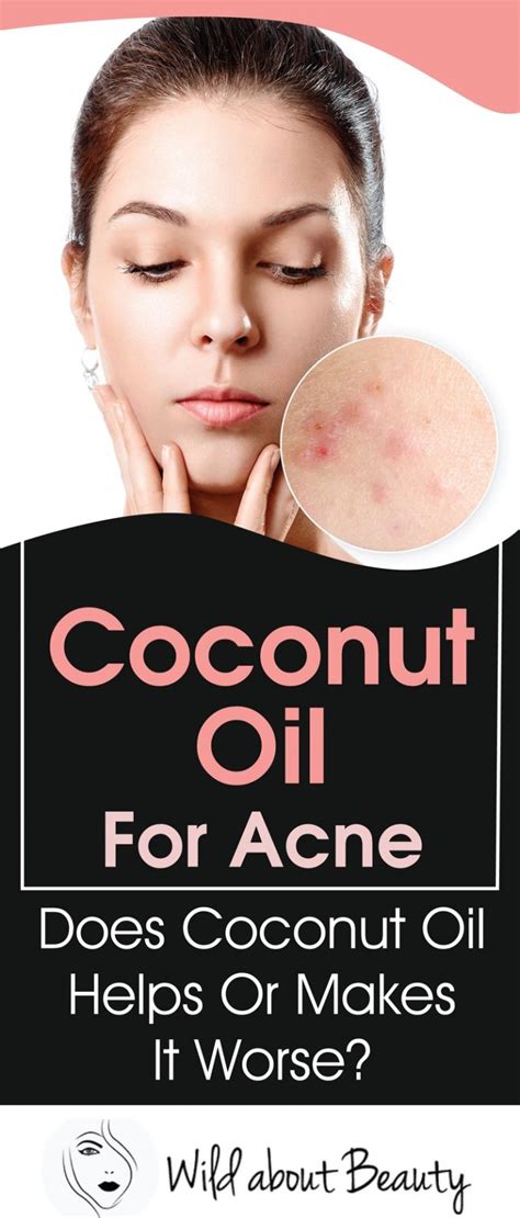 Can coconut oil help fungal acne?