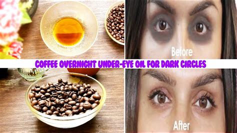 Can coffee remove dark circles?