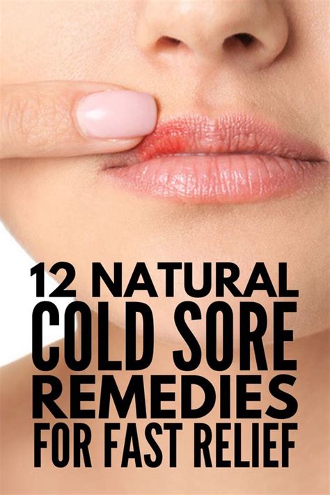 Can cold sores be cured naturally?