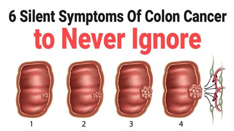 Can colon cancer come back in 3 months?