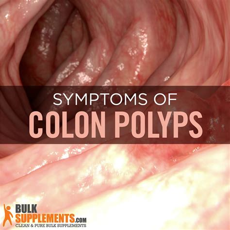 Can colon polyps grow back in a year?