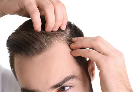 Can dandruff grow back hair?