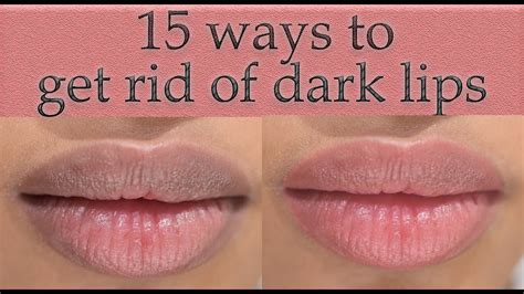 Can dark lips get lighter?