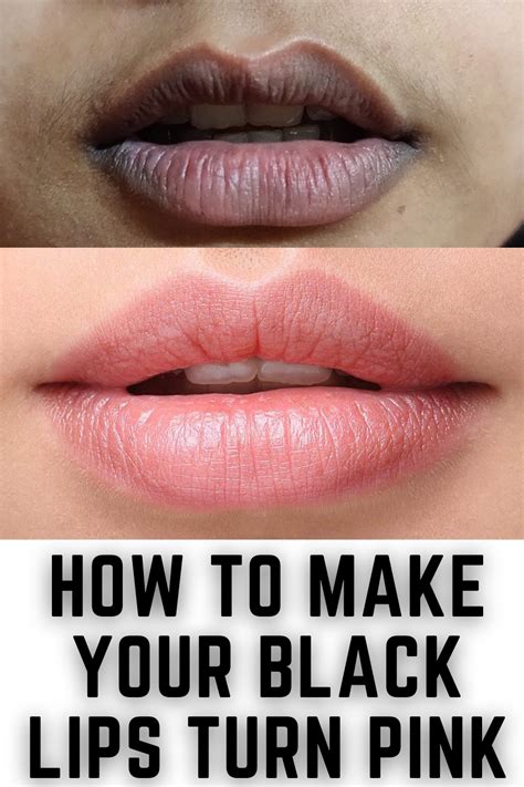 Can dark lips turn pink?