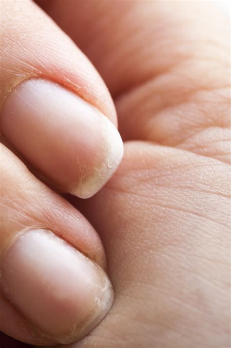 Can dehydration affect fingernails?