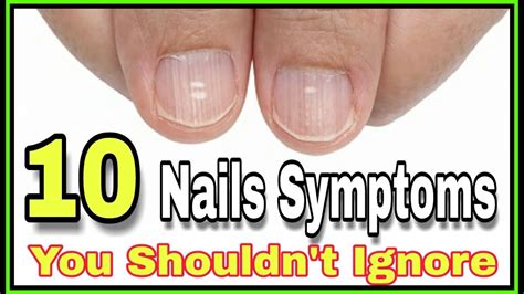 Can dehydration affect your nails?