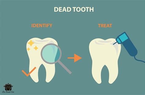 Can dentist save bad teeth?