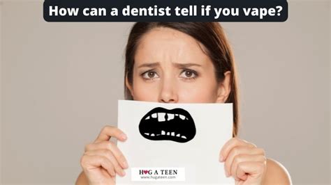 Can dentists tell parents if you vape?