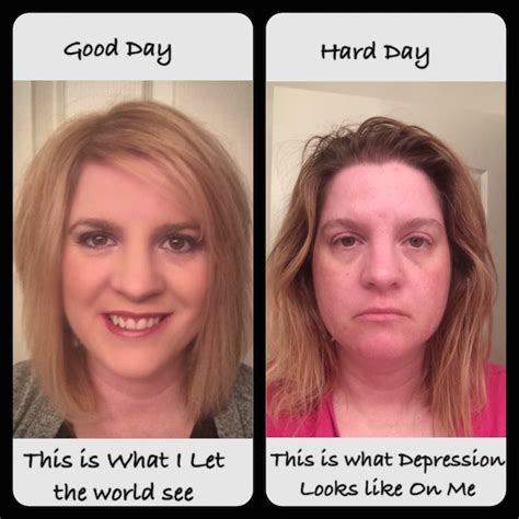 Can depression change your face?