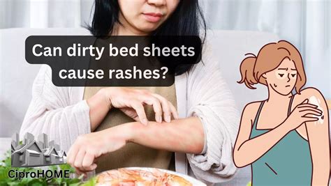 Can dirty bed sheets cause itching?