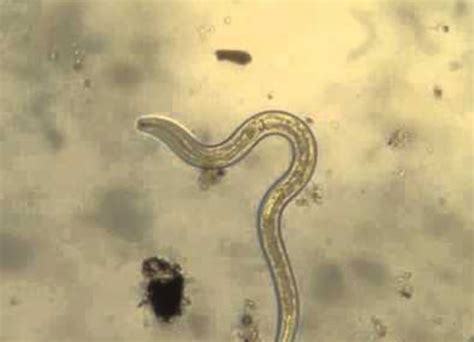Can dirty water cause worms?