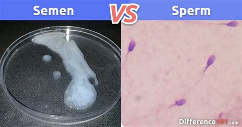Can discharge smell like sperm?