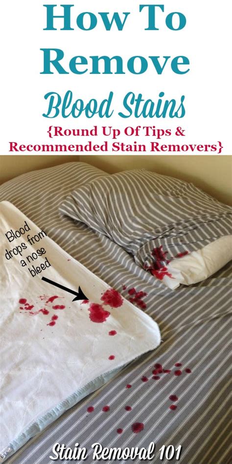 Can dried blood stains be removed?