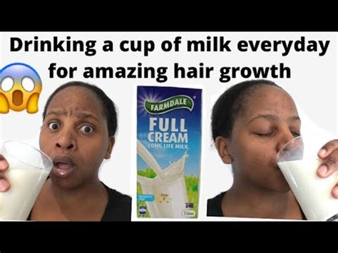 Can drinking milk stop hair loss?
