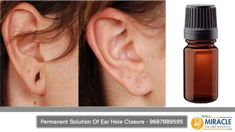 Can ear holes shrink?