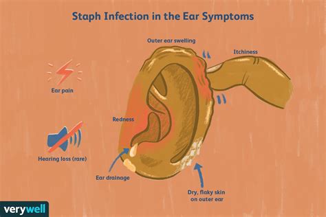 Can ear infection come back after antibiotics?