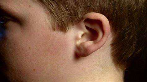 Can ear lobes grow back?