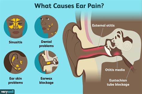 Can ear pain last for weeks?