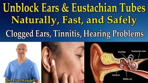 Can ear wax block eustachian tube?