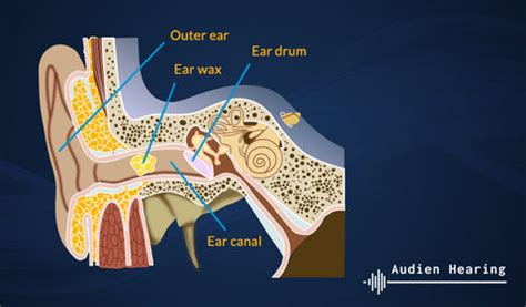 Can earwax cause tinnitus?