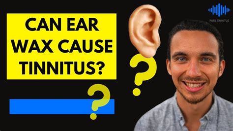 Can earwax cause tinnitus?
