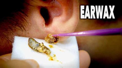 Can earwax destroy headphones?