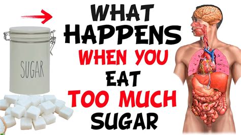 Can eating too much sugar cause pancreatitis?