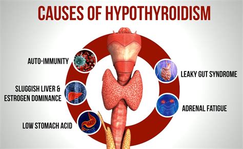 Can emotional trauma cause hypothyroidism?