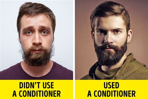 Can every man grow a beard?