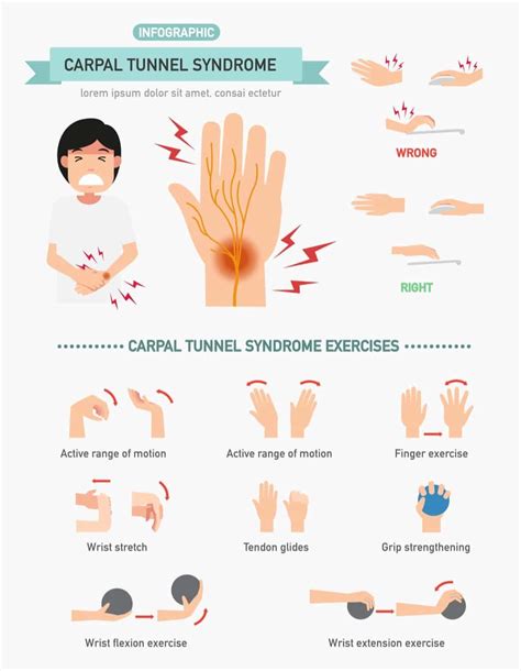 Can exercise make carpal tunnel worse?
