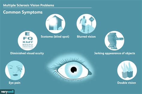 Can eye twitching be MS?