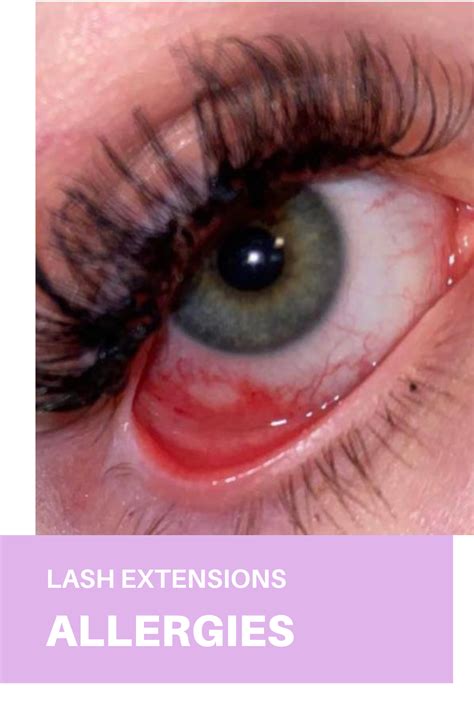 Can eyelash glue cause a fire?