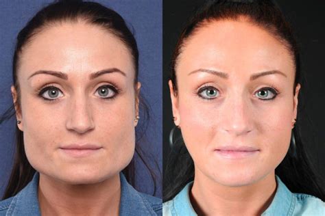 Can face shape change?