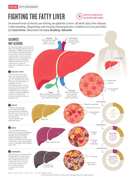 Can fatty liver stage 3 be cured?