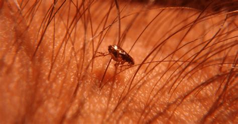 Can fleas live in hair?