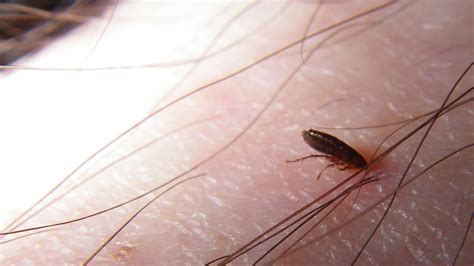 Can fleas live on human?