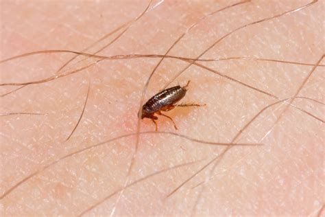 Can fleas live on humans after showering?