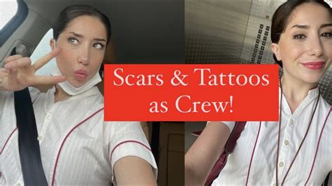 Can flight attendants have scars?