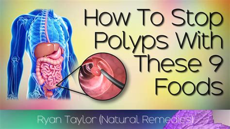 Can food intolerance cause polyps?