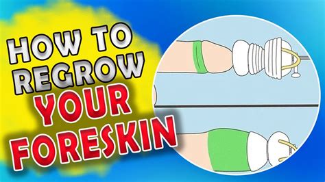 Can foreskin grow back naturally?