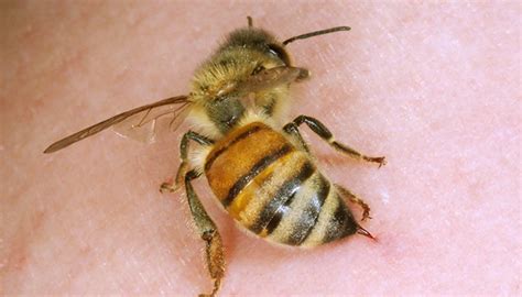 Can fuzzy bee sting you?