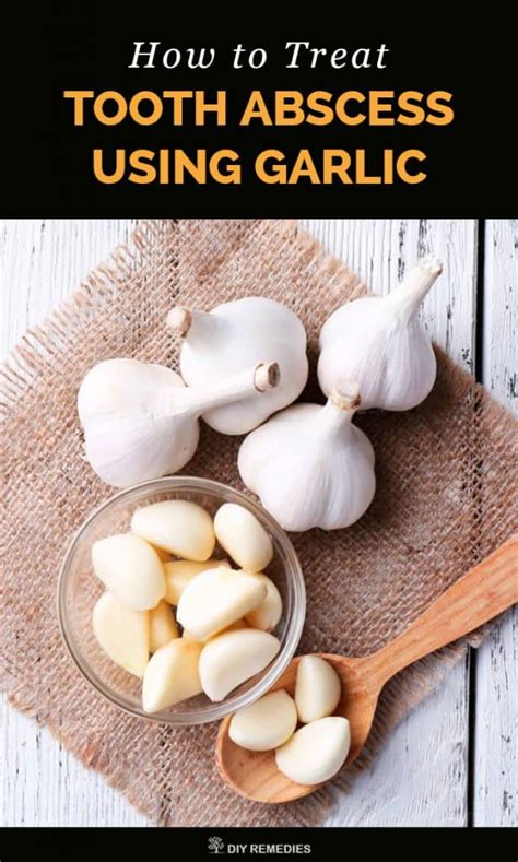 Can garlic cure gum infection?