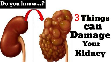 Can garlic damage kidneys?