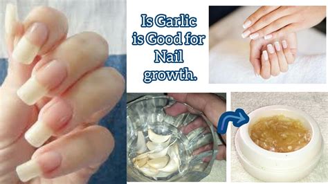 Can garlic grow nails?