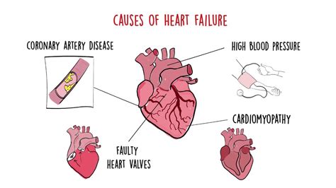 Can glue cause heart failure?