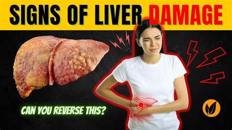 Can glutathione reverse liver damage?