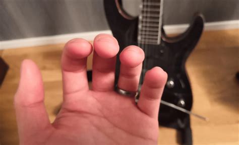 Can guitar deform your fingers?