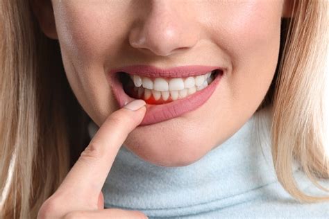 Can gum disease clear up on its own?